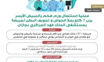 استئصال مبيض مريضة بجازان