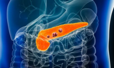 لمرضى “البنكرياس”.. احذروا “المهدئات”