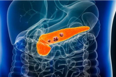 لمرضى “البنكرياس”.. احذروا “المهدئات”